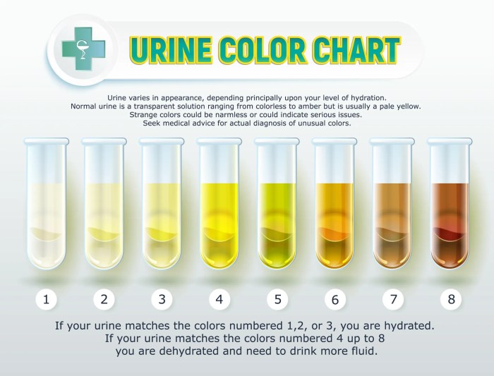 Can food coloring cause pink urine