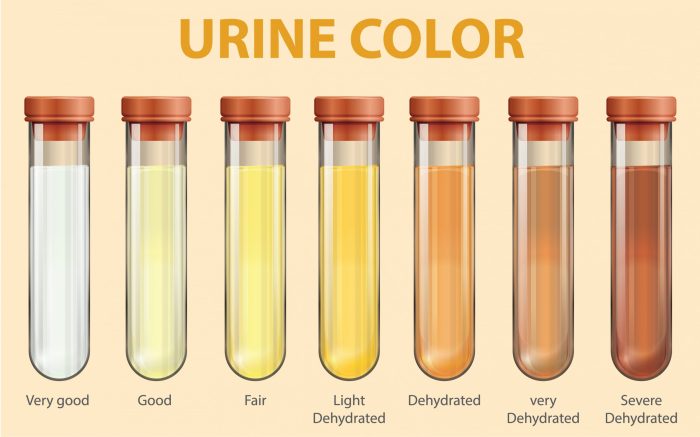 Can Food Coloring Cause Pink Urine?